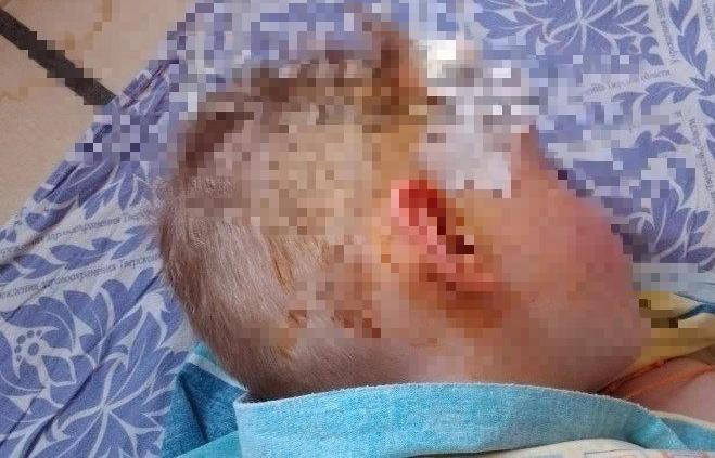 В Твери после травмы 6-летнего мальчика на стадионе полиция провела проверку: на мать составлен протокол