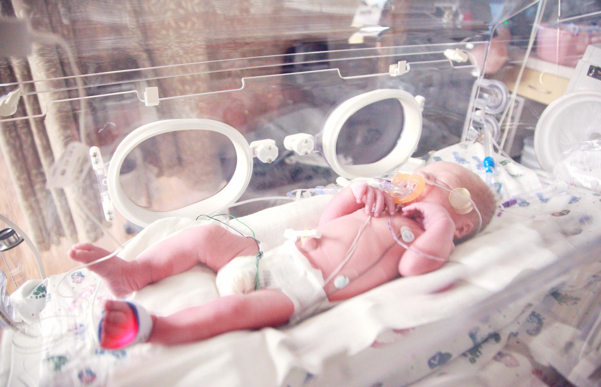 Грудного младенца из Твери с тромбозами экстренно госпитализировали в Санкт-Петербург - новости Афанасий