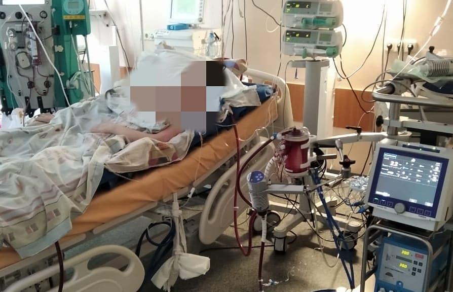 В Твери спасли жизнь больной коронавирусом 16-летней девочке с критическим поражением легких 