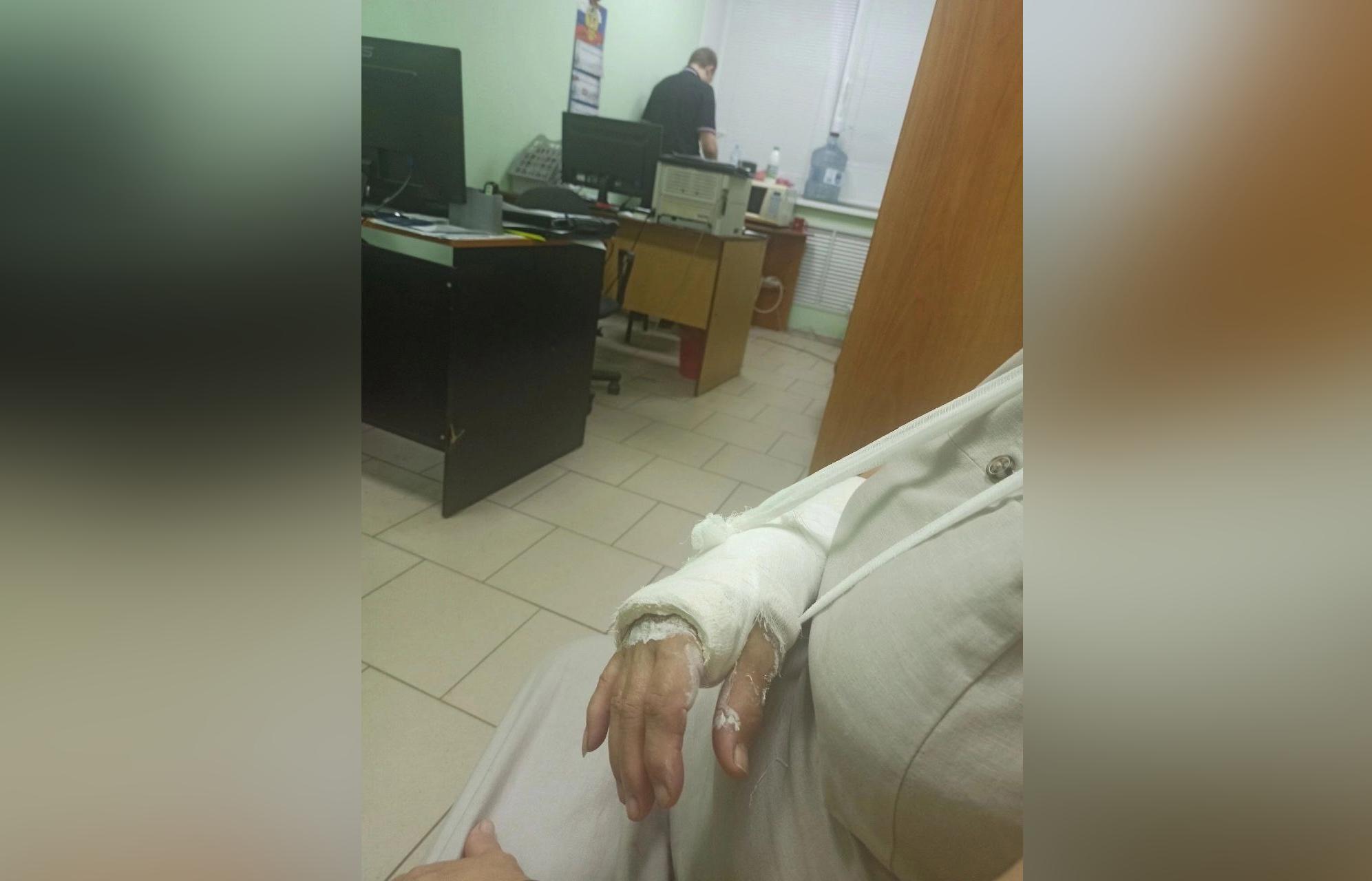 В Твери неадекватный водитель сломал женщине руку