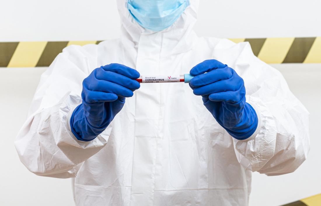 В Тверскую область поступит партия тестов на антитела к коронавирусу